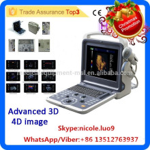 Christmas Promotion!! MSLCU28i 4d color doppler ultrasound system with 4d porbe